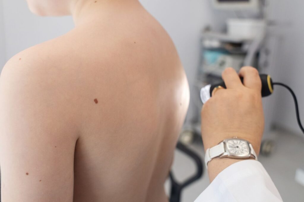 How Often Should You Get a Skin Check in Australia?